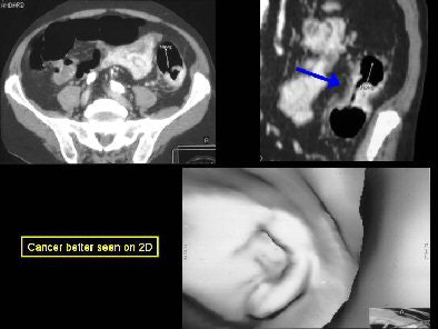 2006 07 21 16 24 25 706