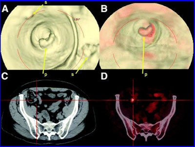 2006 07 26 11 06 19 706