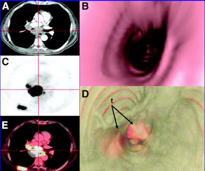 2006 07 26 11 06 32 706