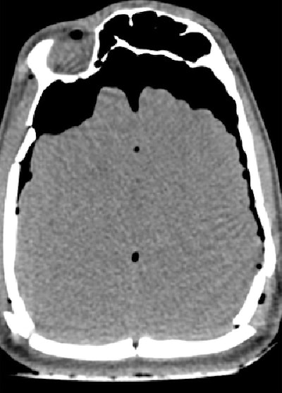 2006 08 02 16 28 55 706