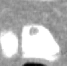 2006 08 07 17 01 11 706