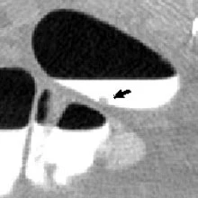 2006 08 07 17 02 14 706