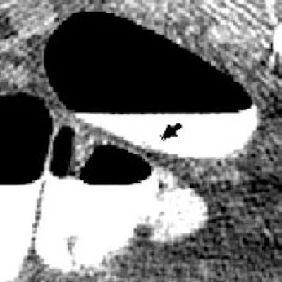 2006 08 07 17 02 28 706