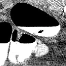 2006 08 07 17 02 41 706