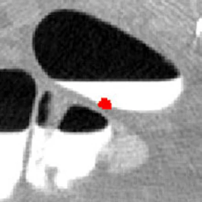 2006 08 07 17 02 54 706