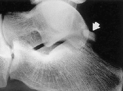 2006 08 11 16 14 48 706