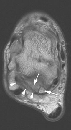 2006 08 11 16 16 34 706