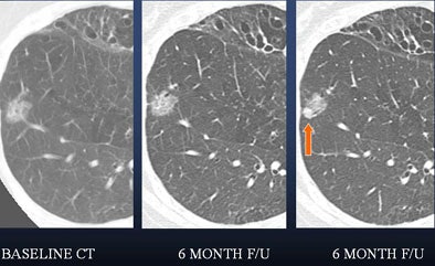 2006 08 15 14 50 01 706