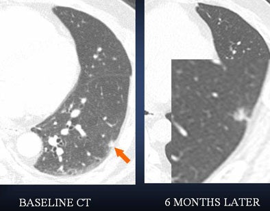 2006 08 15 14 50 13 706