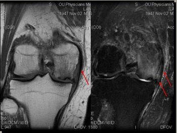 2006 09 01 14 08 31 706