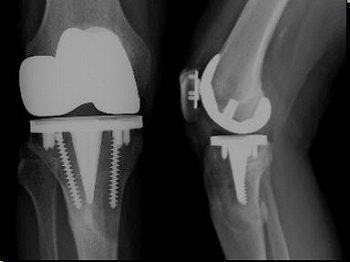 2006 09 01 14 21 39 706