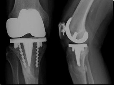 2006 09 01 14 21 39 706