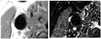 2006 09 01 16 42 08 706