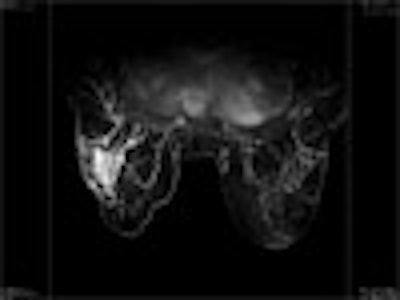 2006 09 11 14 47 52 706