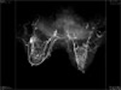 2006 09 11 14 48 23 706