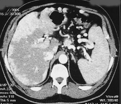 2006 09 13 10 22 06 706