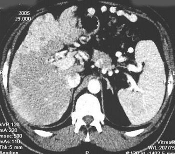 2006 09 13 10 22 38 706