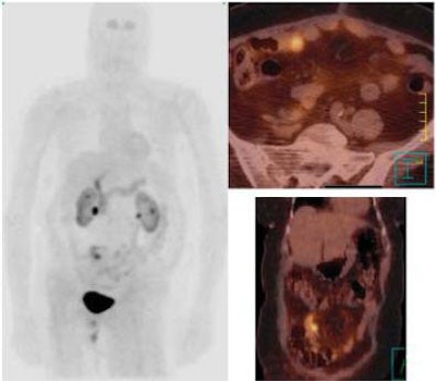 2006 09 13 10 27 37 706