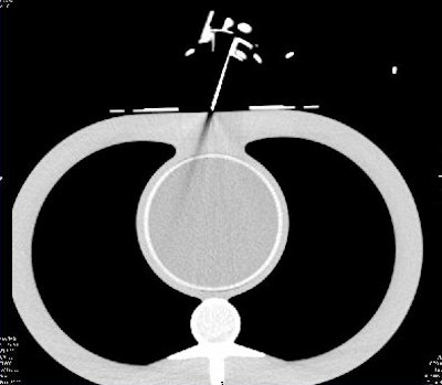 2006 09 18 13 51 26 706