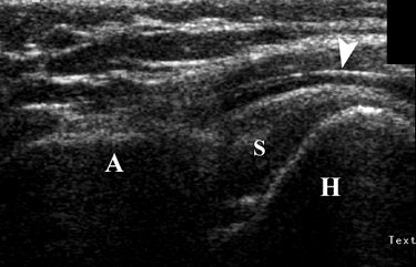 2006 09 25 09 56 49 706