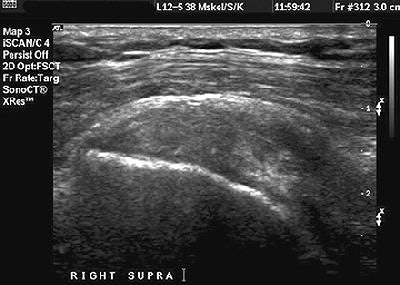 2006 09 25 09 57 01 706