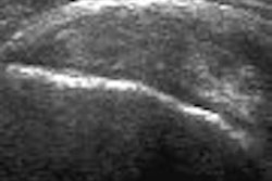 2006 09 25 09 57 15 706