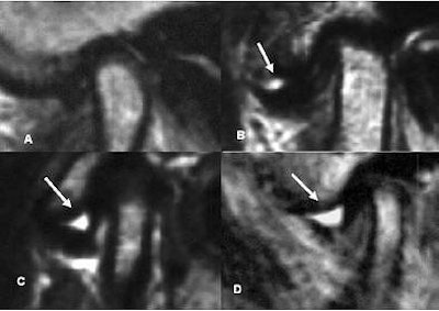 2006 10 06 13 25 39 706