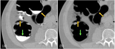 2006 10 10 15 18 57 706