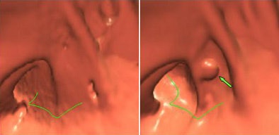 2006 10 10 15 24 14 706