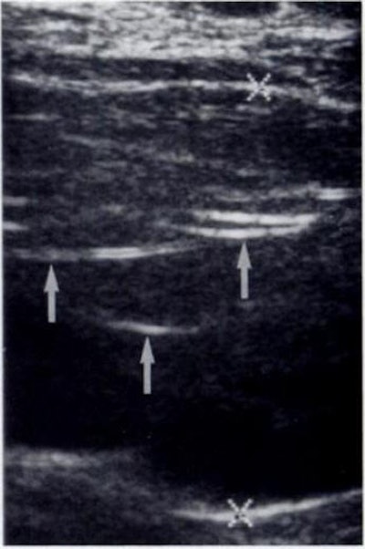 2006 10 10 15 56 55 706