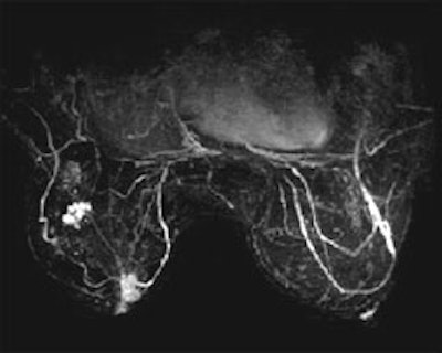 SpiralRODEO Sample Image