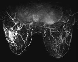 SpiralRODEO Sample Image