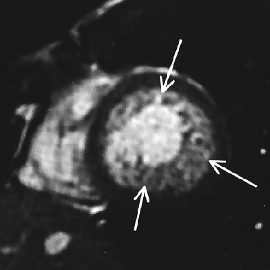 2006 10 17 15 35 42 706