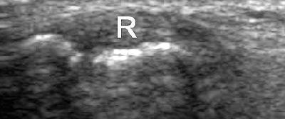 2006 11 01 10 49 19 706