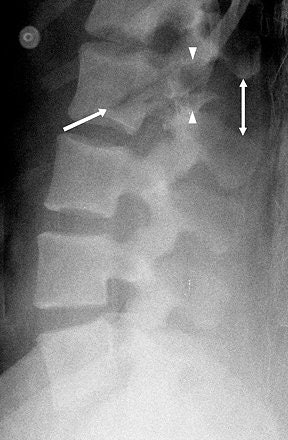 2006 11 08 17 14 59 706