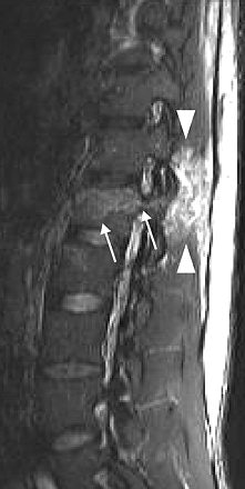 2006 11 08 17 17 15 706