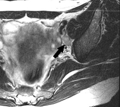 2006 11 10 17 32 29 706