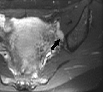 2006 11 10 17 32 39 706