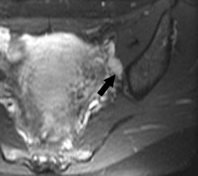 2006 11 10 17 32 39 706