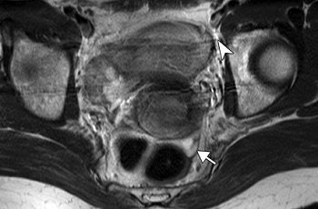 2006 11 10 17 32 49 706