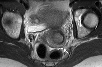 2006 11 10 17 33 00 706