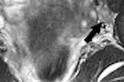 2006 11 10 17 33 11 706