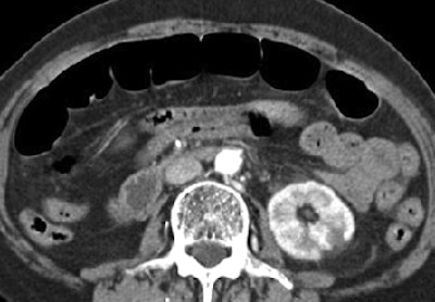 2006 11 14 15 18 57 706