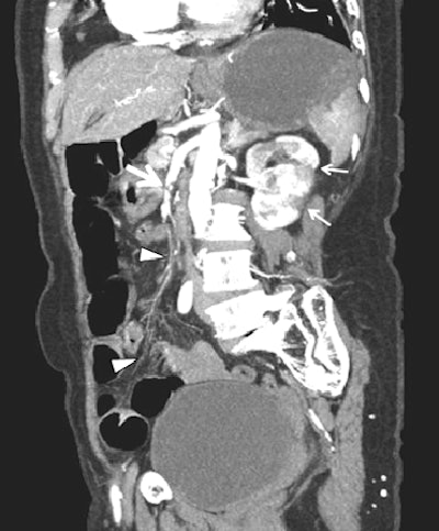 2006 11 14 15 19 24 706