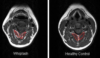 2006 11 15 17 43 11 706