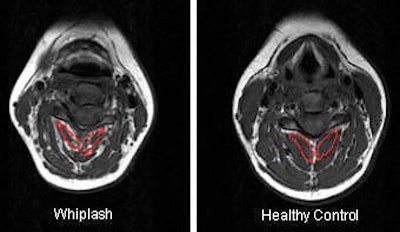 2006 11 15 17 43 11 706