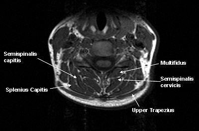 2006 11 15 17 43 22 706