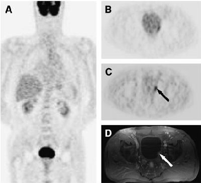 2006 11 20 11 17 47 706