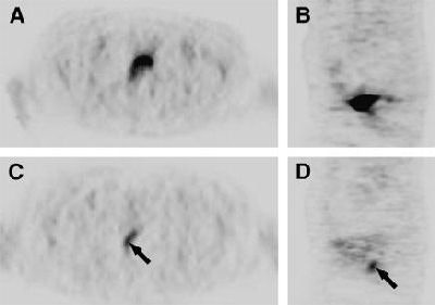 2006 11 20 11 18 35 706