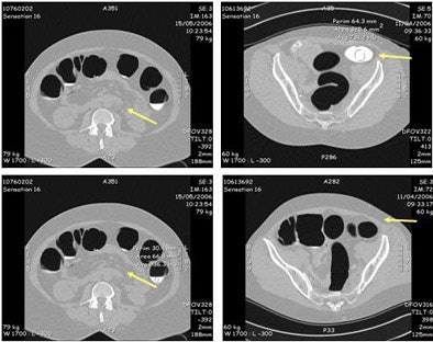 2006 12 05 14 35 04 706
